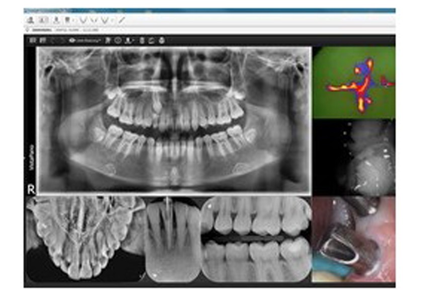 Dürr Dental Imaging Software